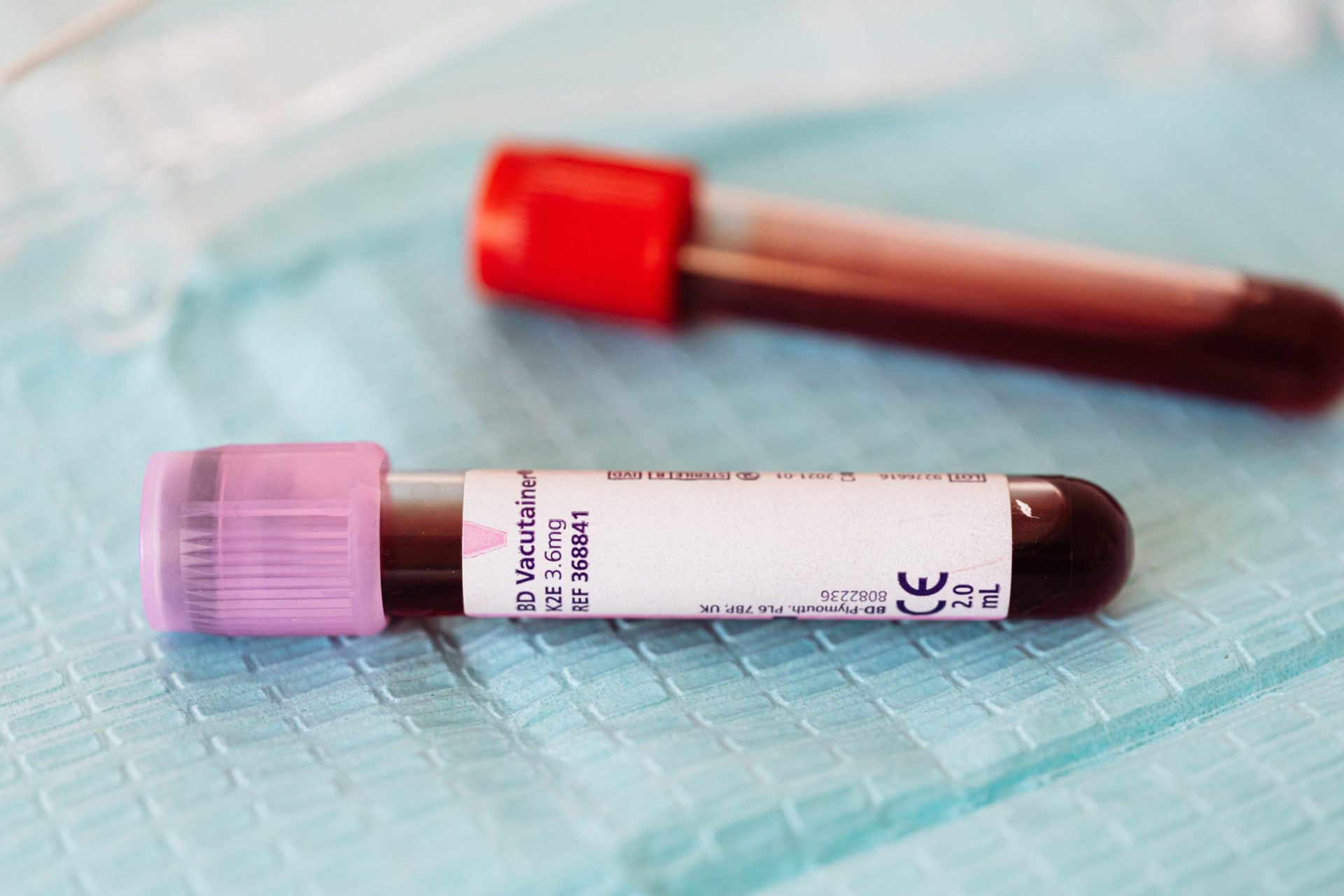 You are currently viewing AST on a Blood Test: The Key Indicator You Should Know for Optimal Health