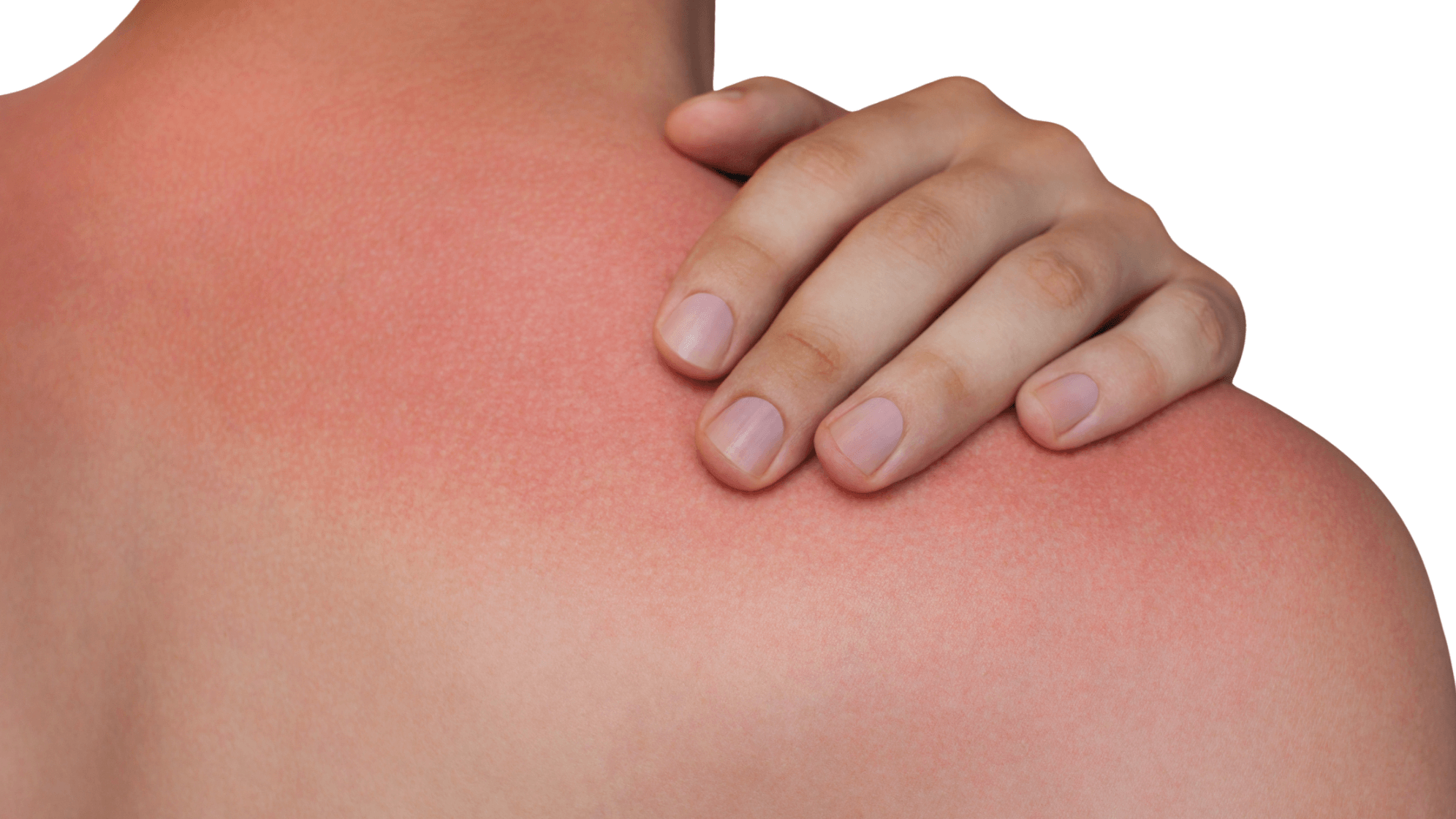 You are currently viewing Is Lyme Disease Contagious? Everything You Need to Know