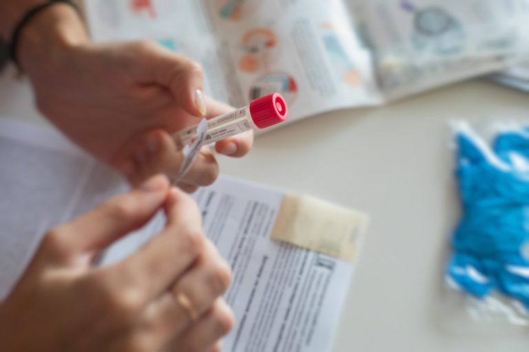 Read more about the article Mobile Phlebotomy Services Simplify Lab Tests in Manhattan