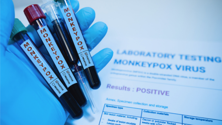Read more about the article Does the Monkeypox Virus Cause Flu-Like Symptoms?