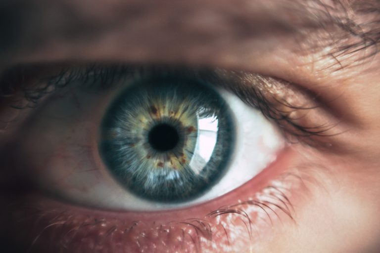 Read more about the article Pink Eye: How Long Does It Last and What You Can Do to Speed Up Recovery
