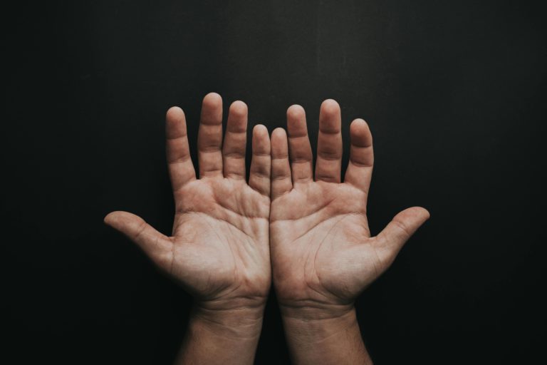 Read more about the article Why Are My Hands Always Sweaty? The Surprising Truth You Need to Know