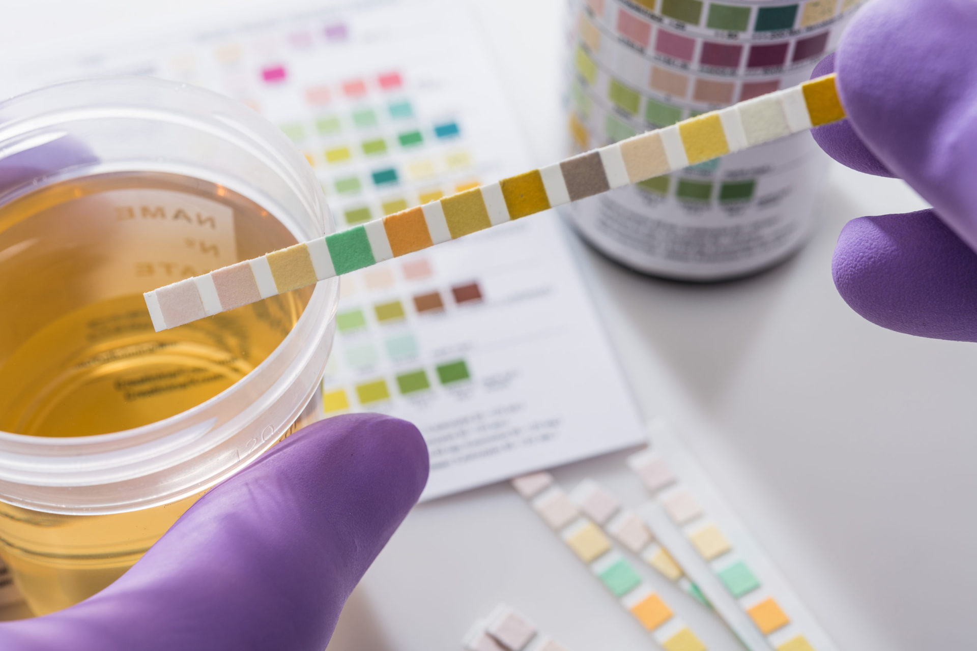 You are currently viewing Urine Toxicology: Understanding the Power of Diagnostic Testing